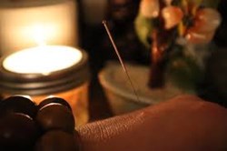 Modern Mindset: Beating stress with acupuncture